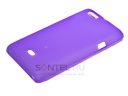   Sony Xperia Miro   ..
