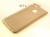   TPU Case   Xiaomi Redmi 5X/Mi A1 