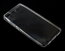   Jack Case  Xiaomi mi 5s 
