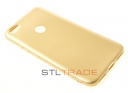   TPU Case   Xiaomi redmi note 5A prime 