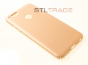  PC  Xiaomi Redmi 5X/Mi A1  Soft Touch  