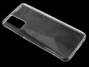   Jack Case  Huawei Honor 30s 